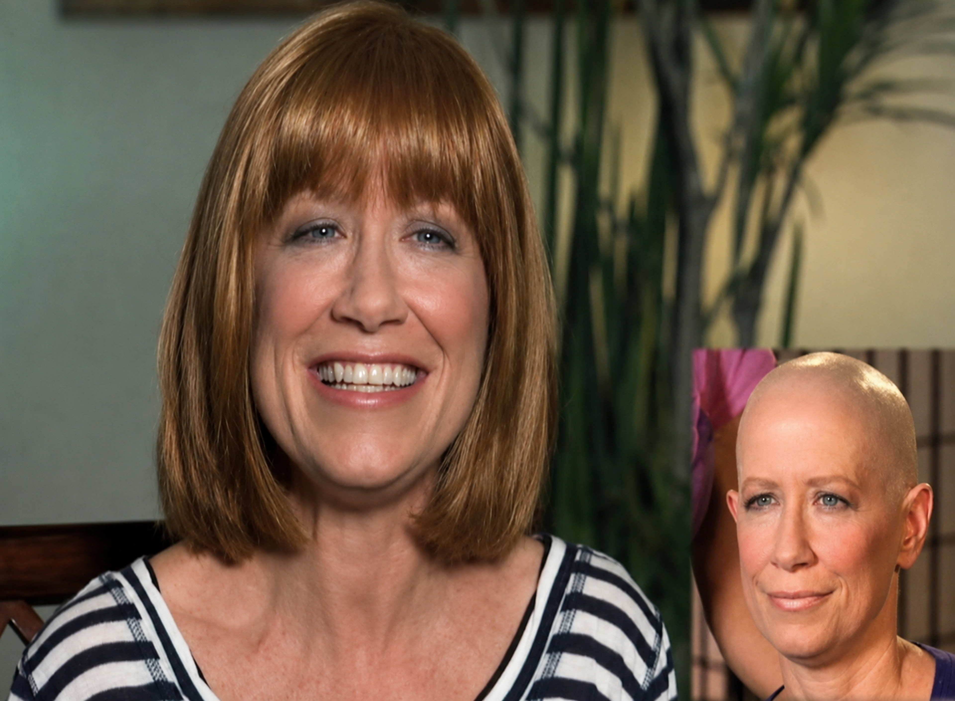 Female client after hair replacement with before view inset
